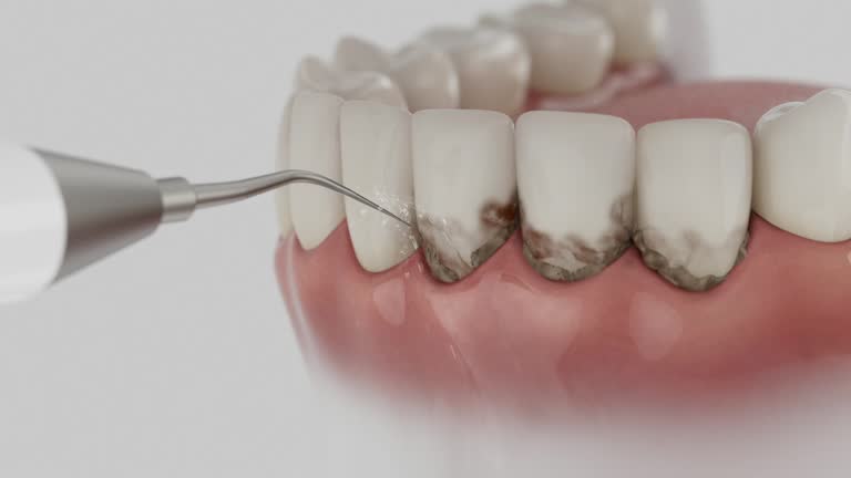 Reliable Dental Implants contractor in Mapleton, UT by Smile Center Dentistry